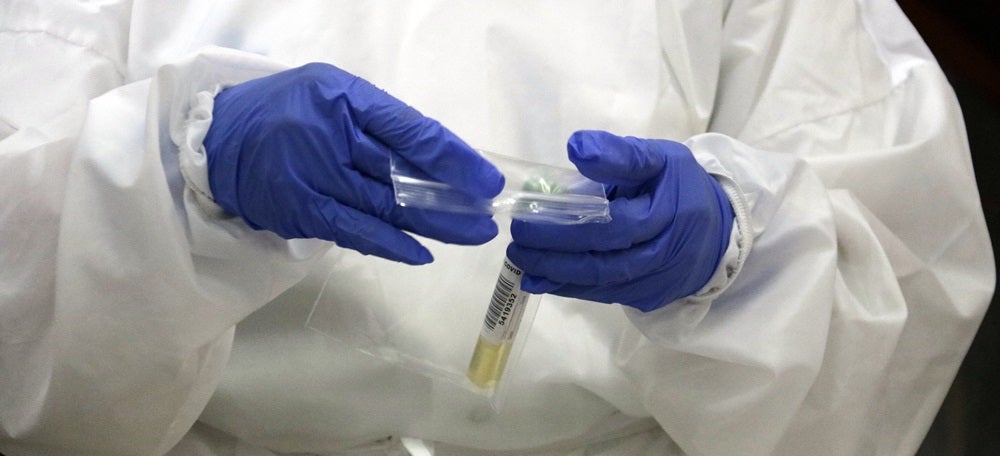 Pla detall d'unes de les mostres per a PCR. Foto del 24 de setembre del 2020 (horitzontal)