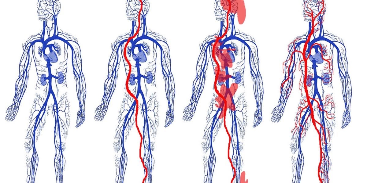 Foto portada: si en un cos biològic hi fas un by-pass, com una nova artèria aorta, obtens una embòlia. Per a resoldre una més potent irrigació et cal augmentar totes les categories de xarxa. Font: Manel Larrosa.