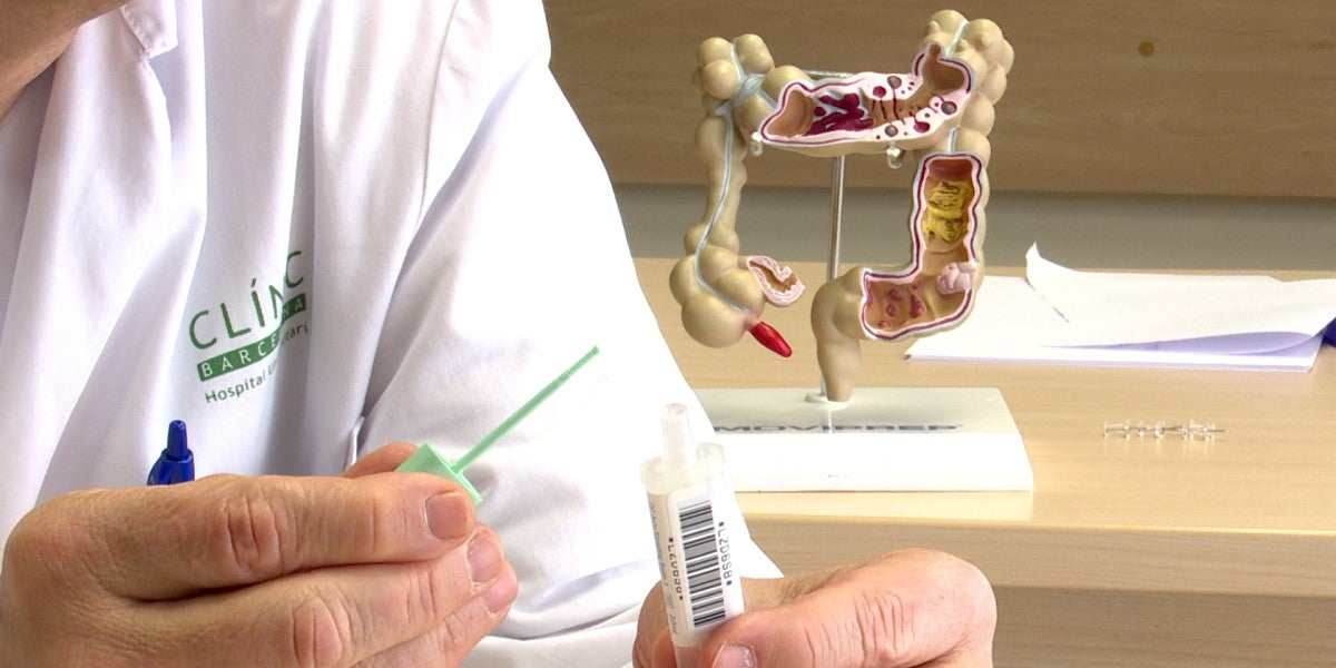 Mostra del tub que s'utilitza per al cribatge del càncer de recte. Autor: ACN.