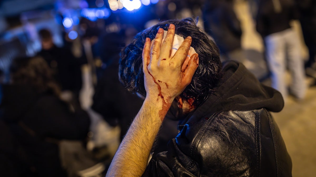 Un ferit per la càrrega policial. Autor: ACN. 