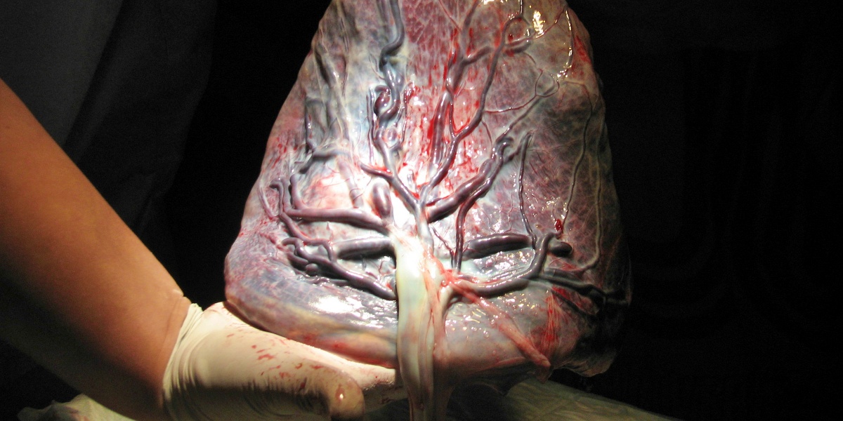 Foto portada: una placenta. Foto original: Greger Ravik via Flickr. Llicència CC retallada.