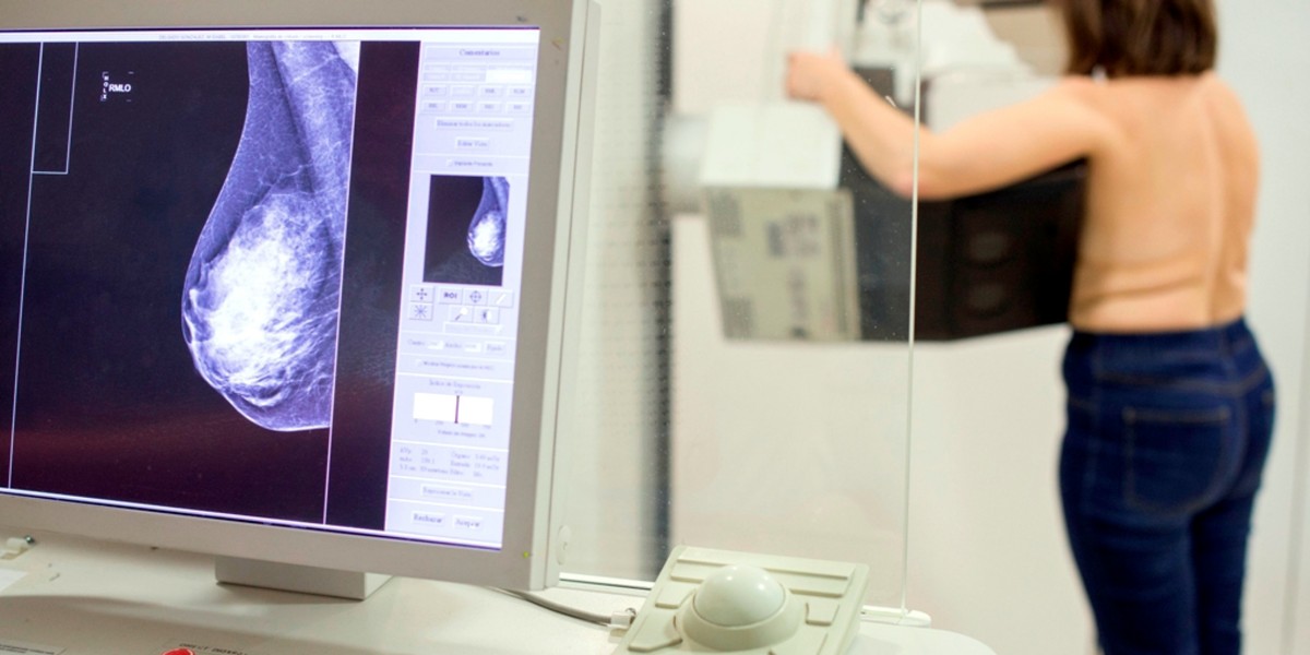Una mamografia. Font: ACN