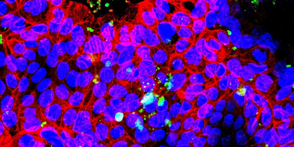 Foto de portada: les imatges de la microscòpia mostren la capacitat dels nanoplàstics per interactuar amb les cèl·lules intestinals. Autor: cedida