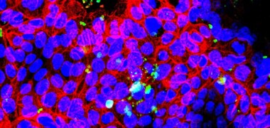 Foto de portada: les imatges de la microscòpia mostren la capacitat dels nanoplàstics per interactuar amb les cèl·lules intestinals. Autor: cedida